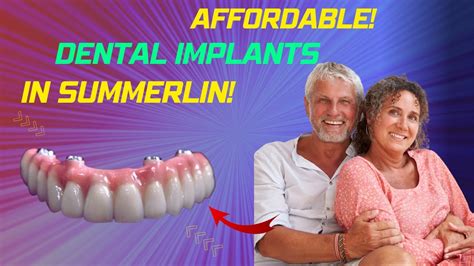 dental implants summerlin nv.